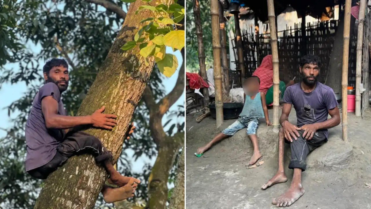 এক পা অচল, তবুও গাছের মগডালে উঠে সংসার চালান একরামুল